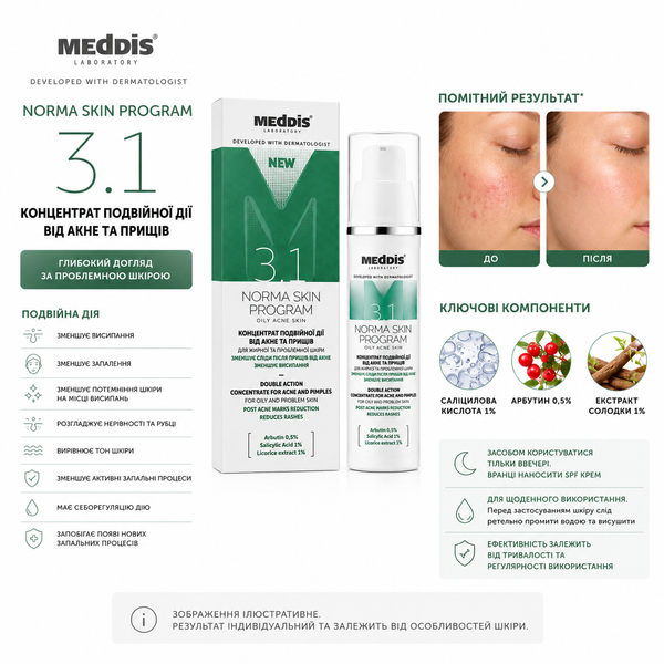 Концентрат подвійної дії проти акне та прищів Meddis Norma Skin Program 0000020 фото